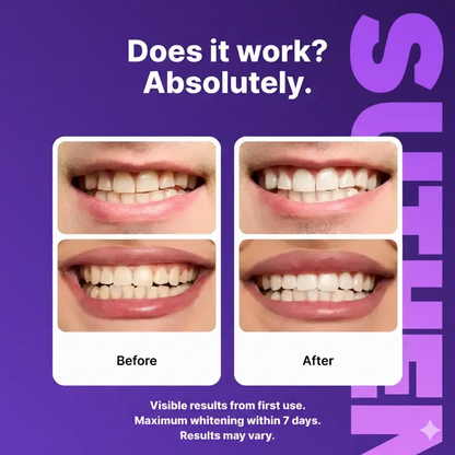 SUTHE™ Purple Teeth Whitening Strips